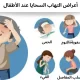 أعراض التهاب السحايا عند الأطفال
