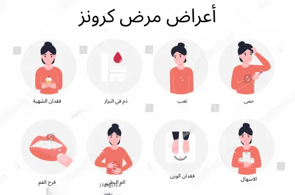 أعراض مرض كرونز