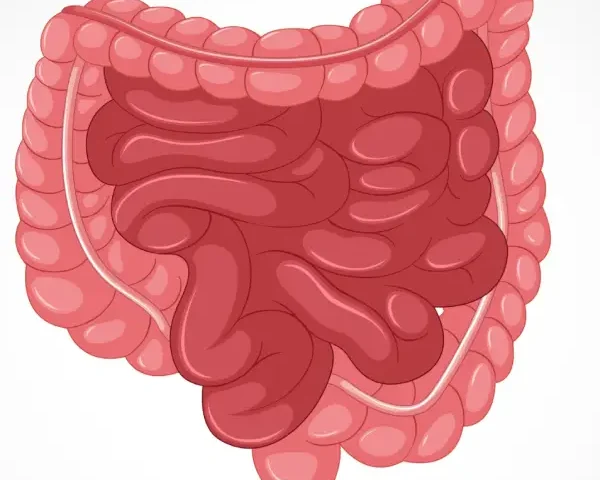 أعراض ارتشاح الأمعاء