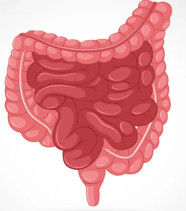 أعراض ارتشاح الأمعاء