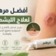 مرهم لعلاج اللشمانيا