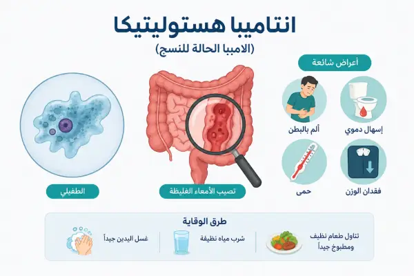 انتاميبا هستوليتيكا